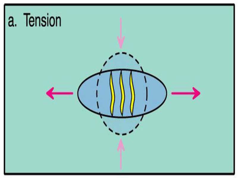 Tension